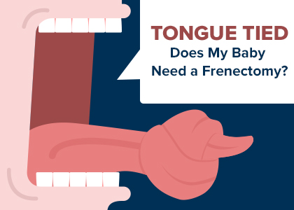 Houston dentist, Dr. Meghna Dassani at Dassani Dentistry, discusses different types of frenums, how they can cause problems for your baby’s mouth, and treatment with frenectomy.
