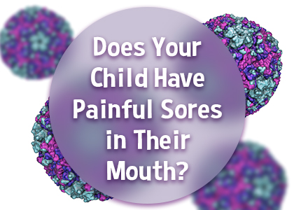 Houston dentist, Dr. Meghna Dassani at Dassani Dentistry tells parents about a common viral infection that may present with sores in your child’s mouth.