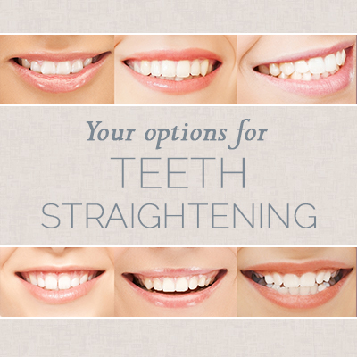 Houston dentist, Dr. Megnha Dassani at Dassani Dentistry shares all you need to know about choosing the right teeth straightening option for you.