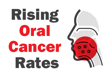 Rising oral cancer rates