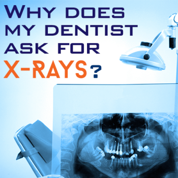 Houston dentist, Dr. Meghna Dassani at Dassani Dentistry, discusses the importance of dental x-rays for accurate diagnosis and treatment planning.